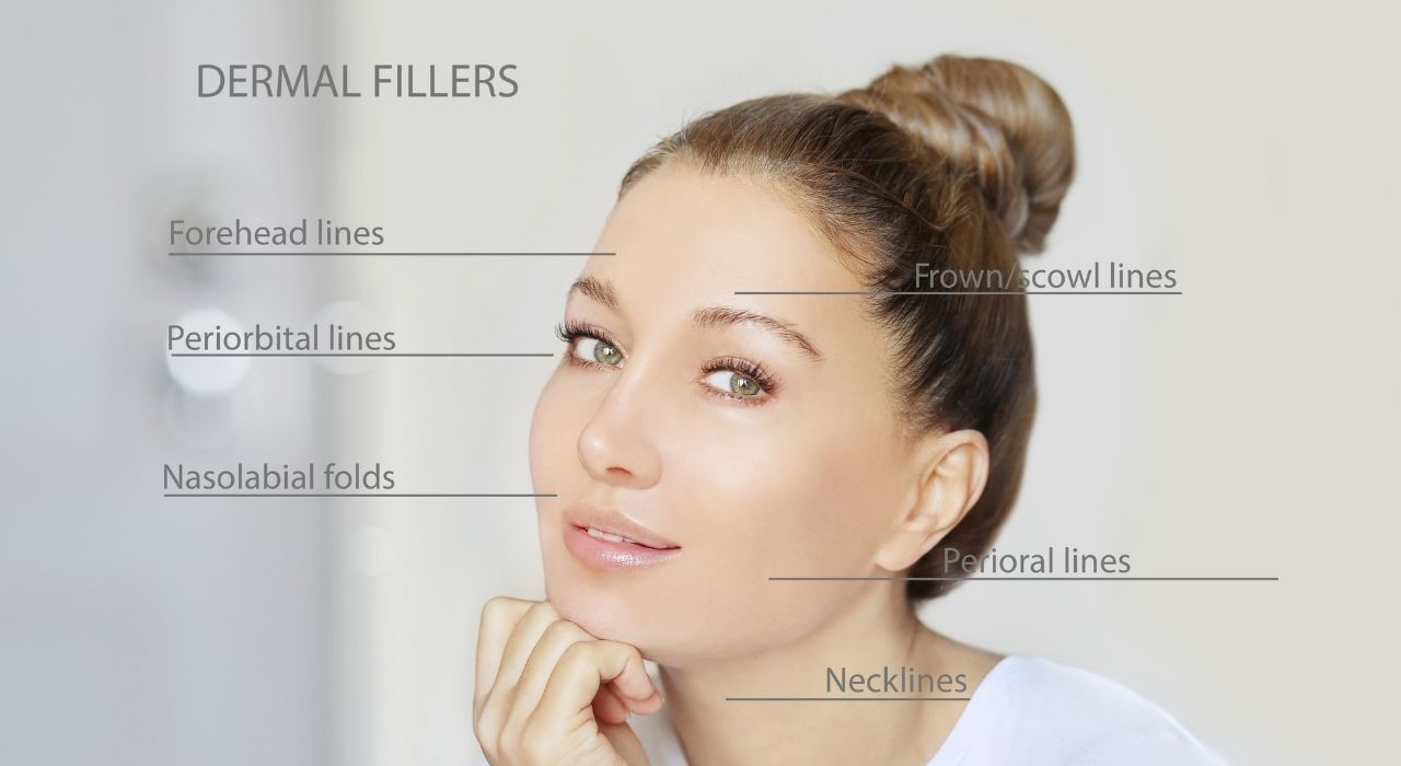 Can Dermal Fillers Fix My Acne Scars?